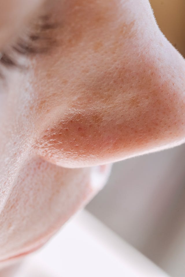 ENT Treatment for Nasal Polyps